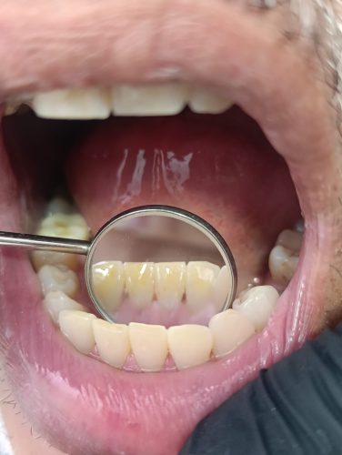 periodoncia_